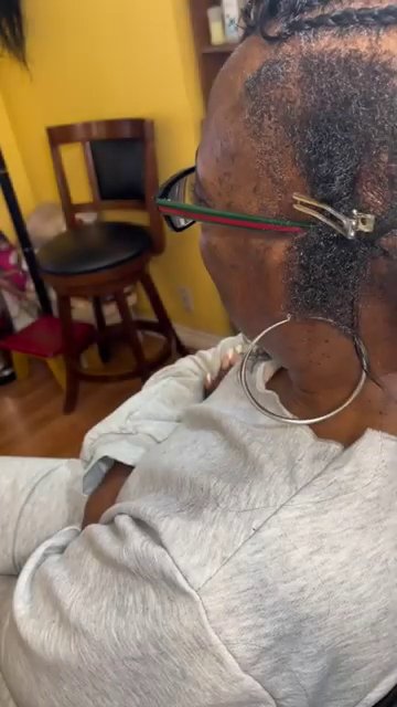 Close-up of the illusion hairline, showing no visible knots and a natural look.